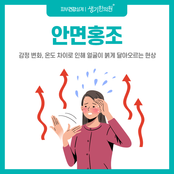 안면가스 이미지