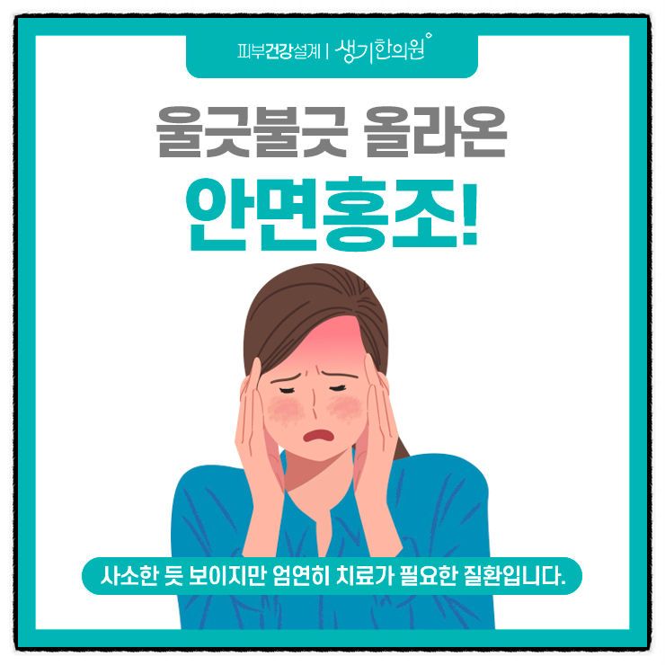안면가스 이미지