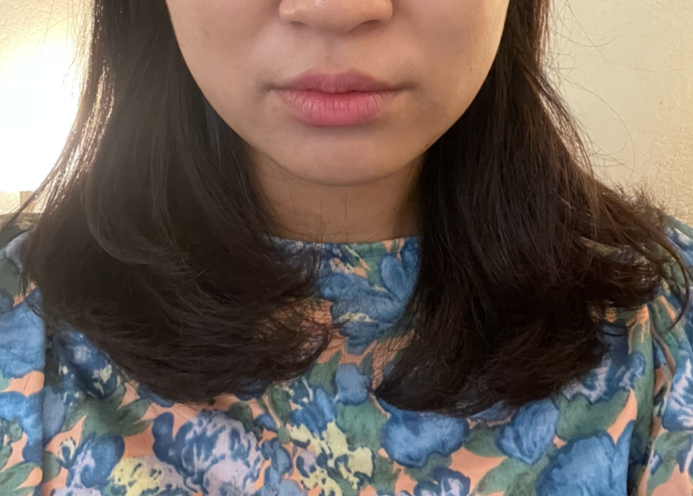 플라덴성형외과 이미지