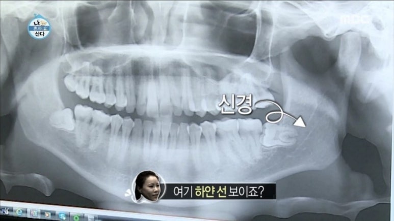 사랑니빠지는구강악안면외과치과의원 이미지