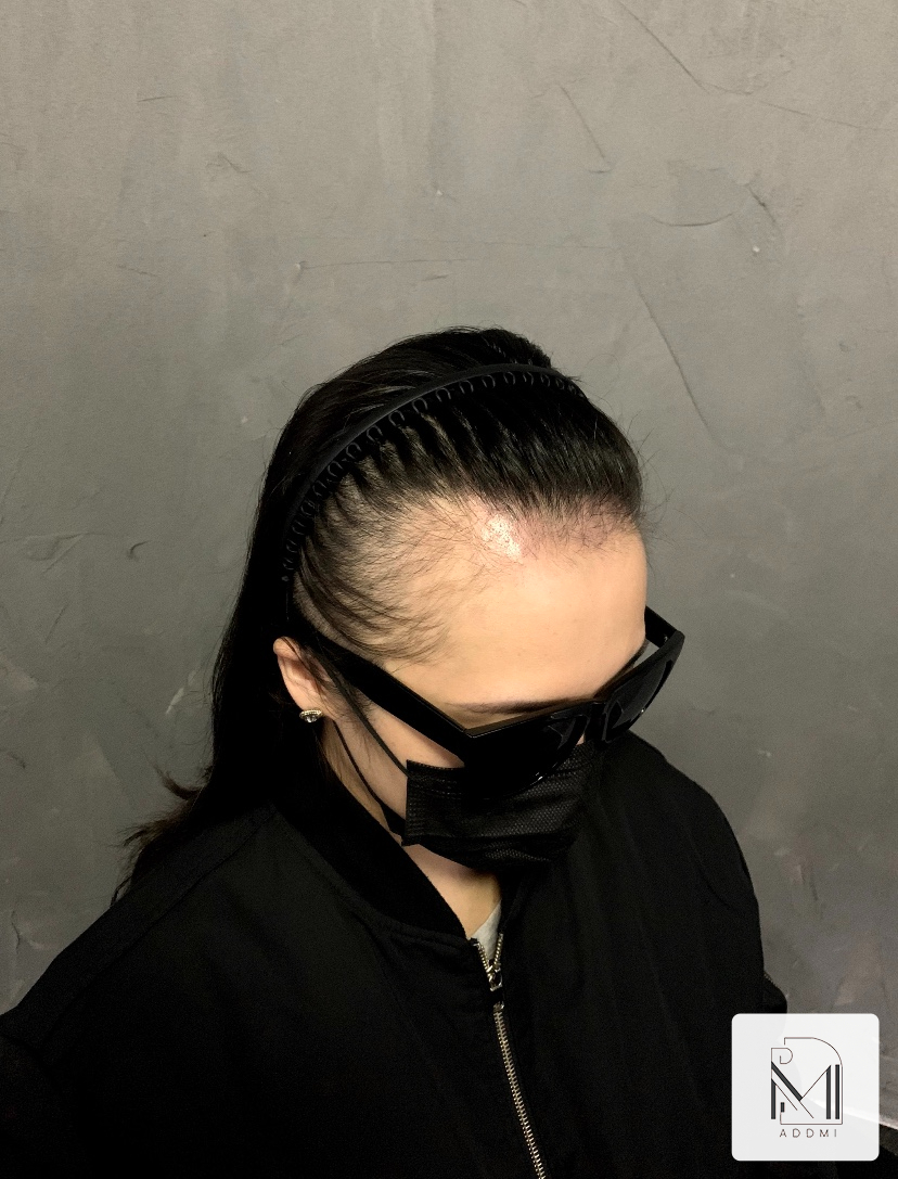 미에미헤어 이미지