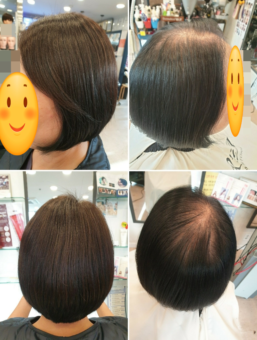 루아헤어&가발 이미지