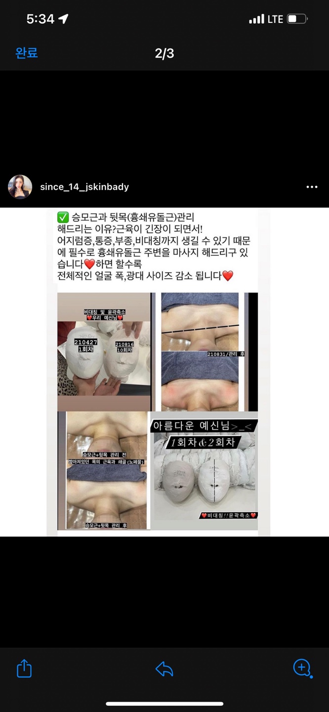 경락관리 이미지
