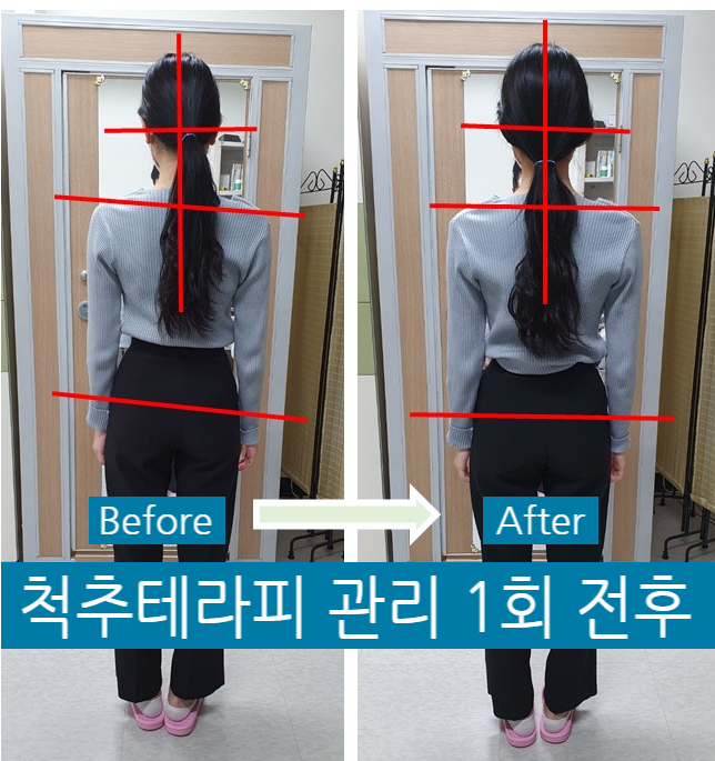 바른체형척추관리 이미지