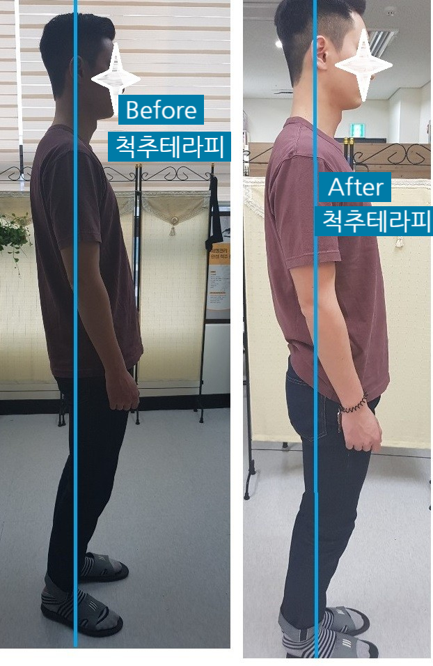 체형관리 이미지