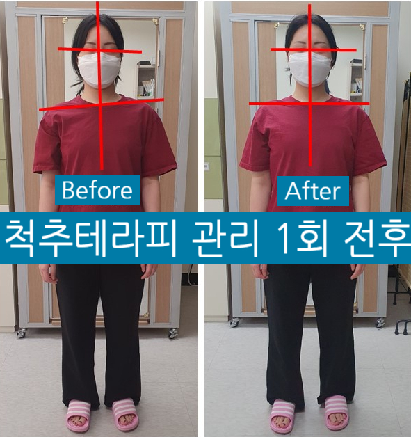 바른체형척추관리 이미지