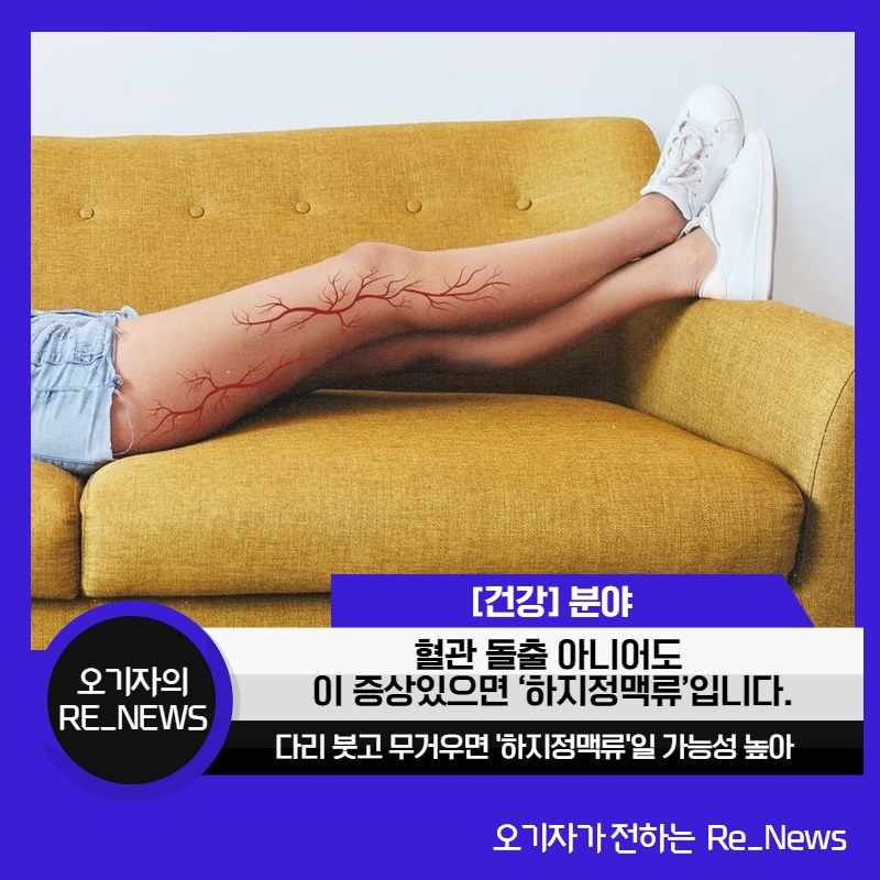 오_라이팅 이미지
