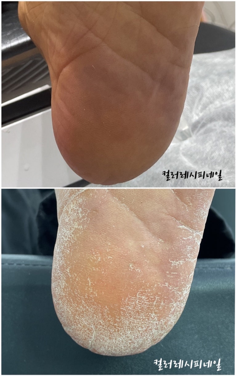 컬러레시피네일 이미지
