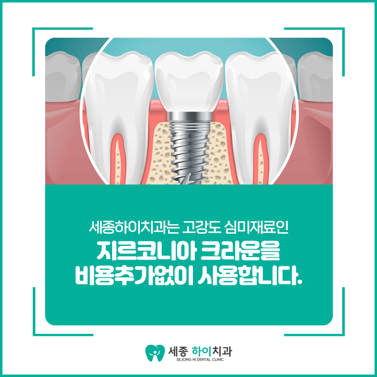 세종하이치과 이미지