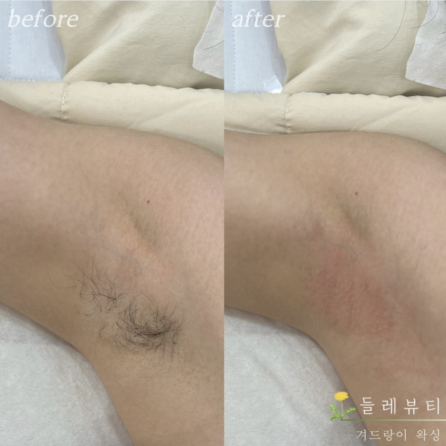 들레뷰티 이미지