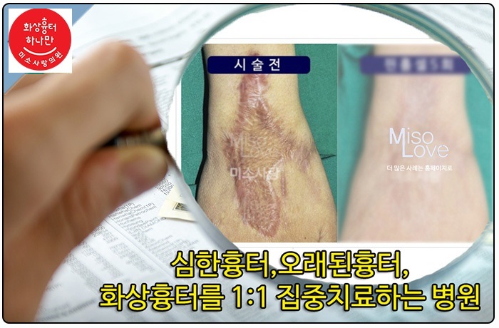 미소사랑의원 이미지
