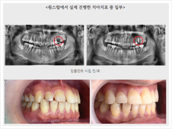 김민우치과의원 이미지