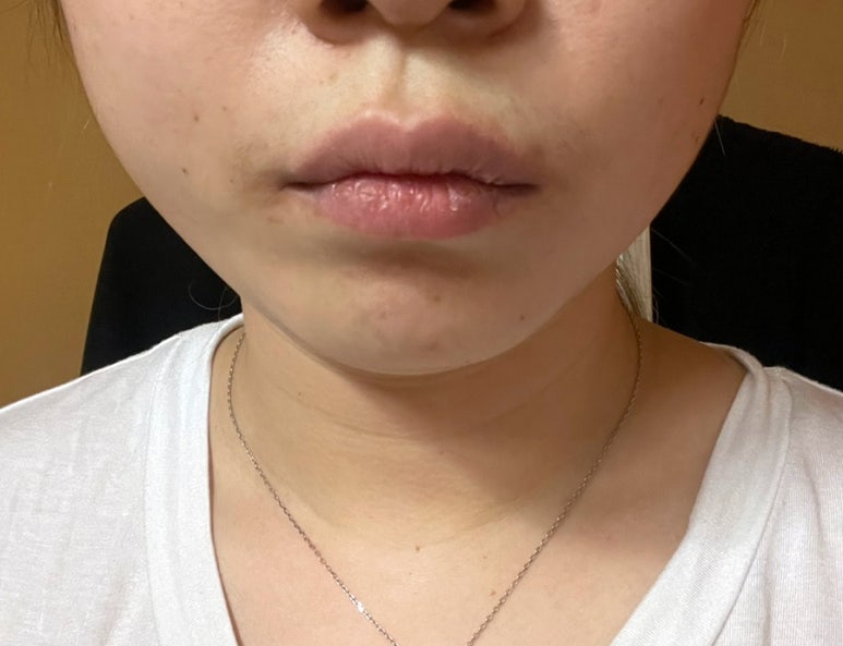가인치과의원 이미지