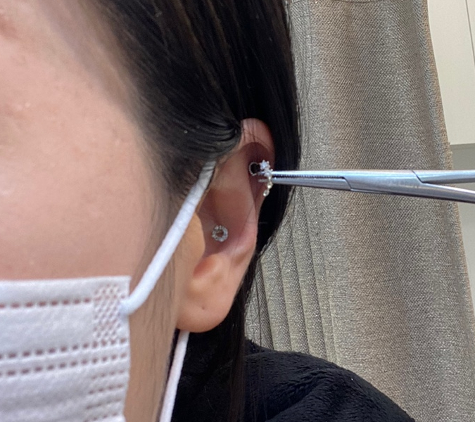 메디컬피어싱.도도 이미지