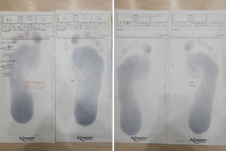 알즈너 명품발 대리점 이미지