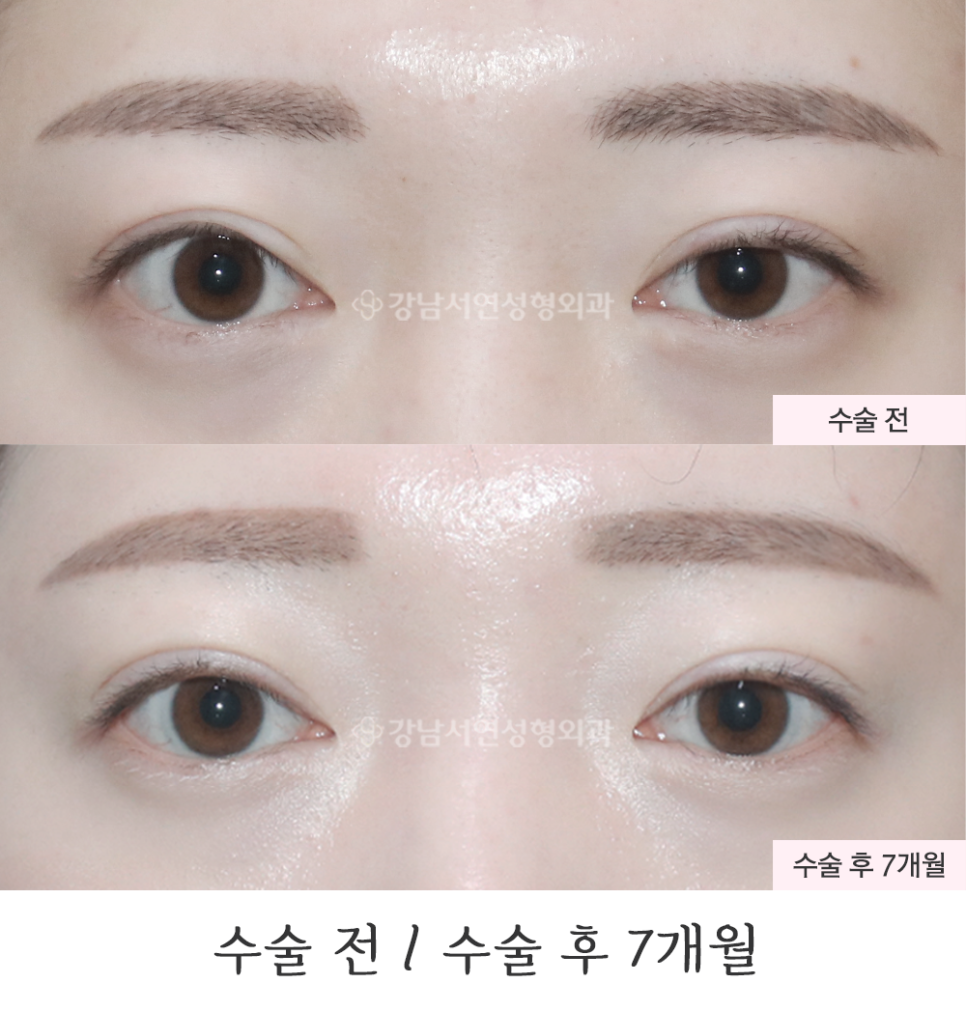 서연성형외과의원 이미지