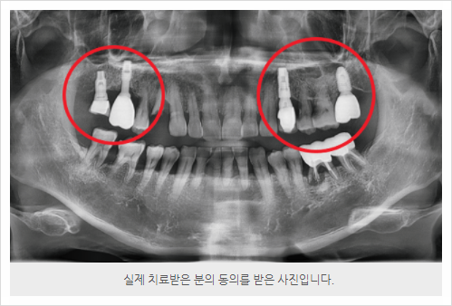 김민우치과의원 이미지