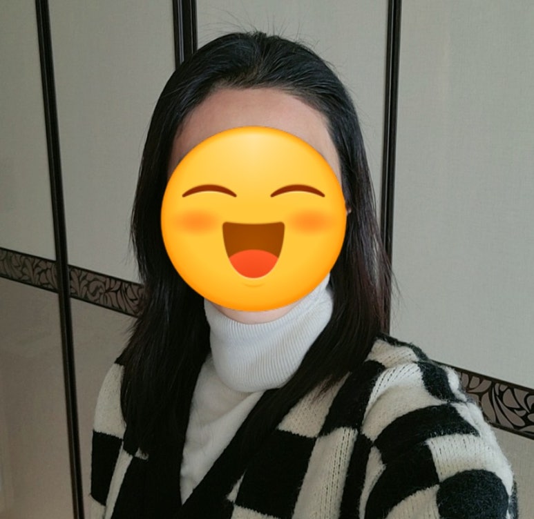 에이스 헤어라인 이미지