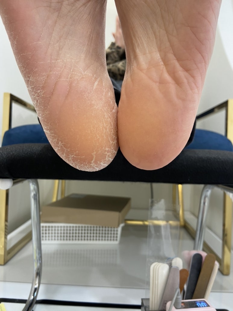 다뷰네일 이미지