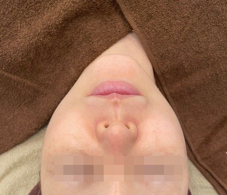뮤즈테라피 이미지