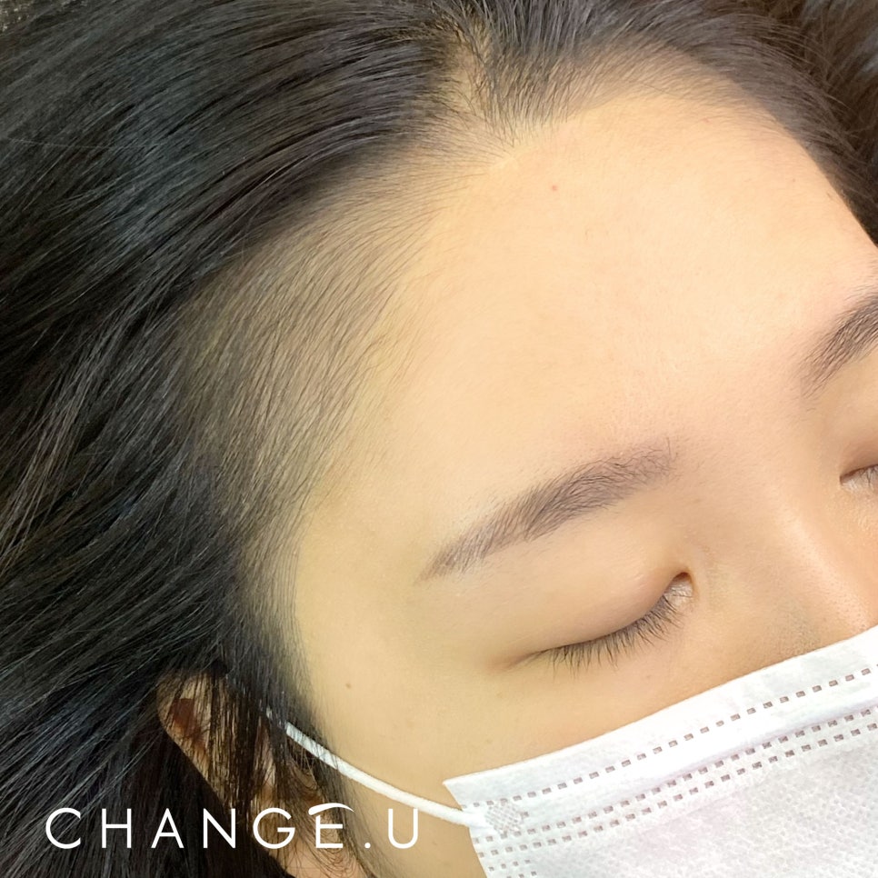 체인지헤어라인 이미지