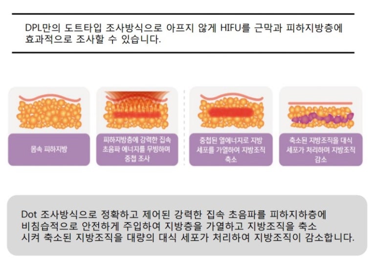 디피엘 이미지