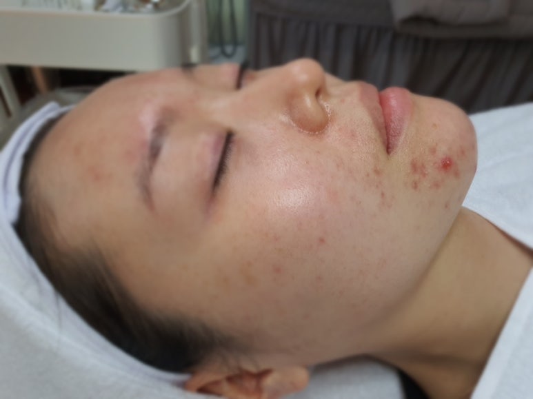 라미아루체 이미지