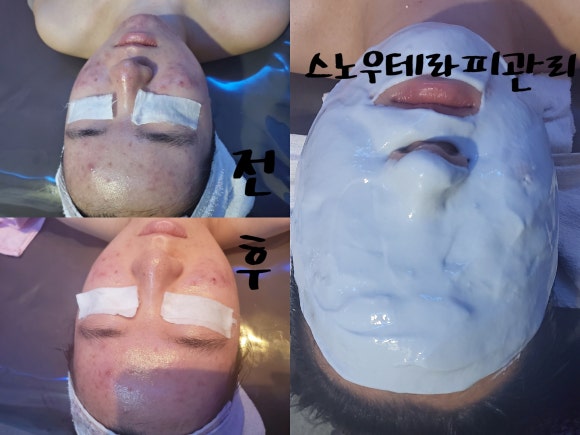 미향스킨케어 이미지