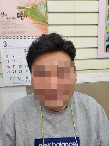 셀모가발 이미지