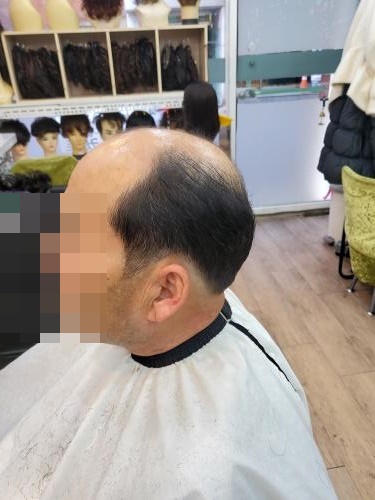 셀모가발 이미지