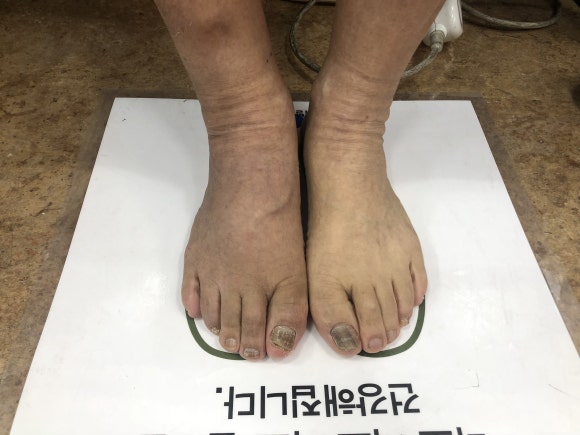 신체발란스운동연구소 이미지