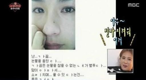 멍브로 이미지