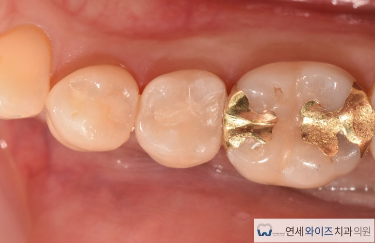 e-하나로치과 이미지