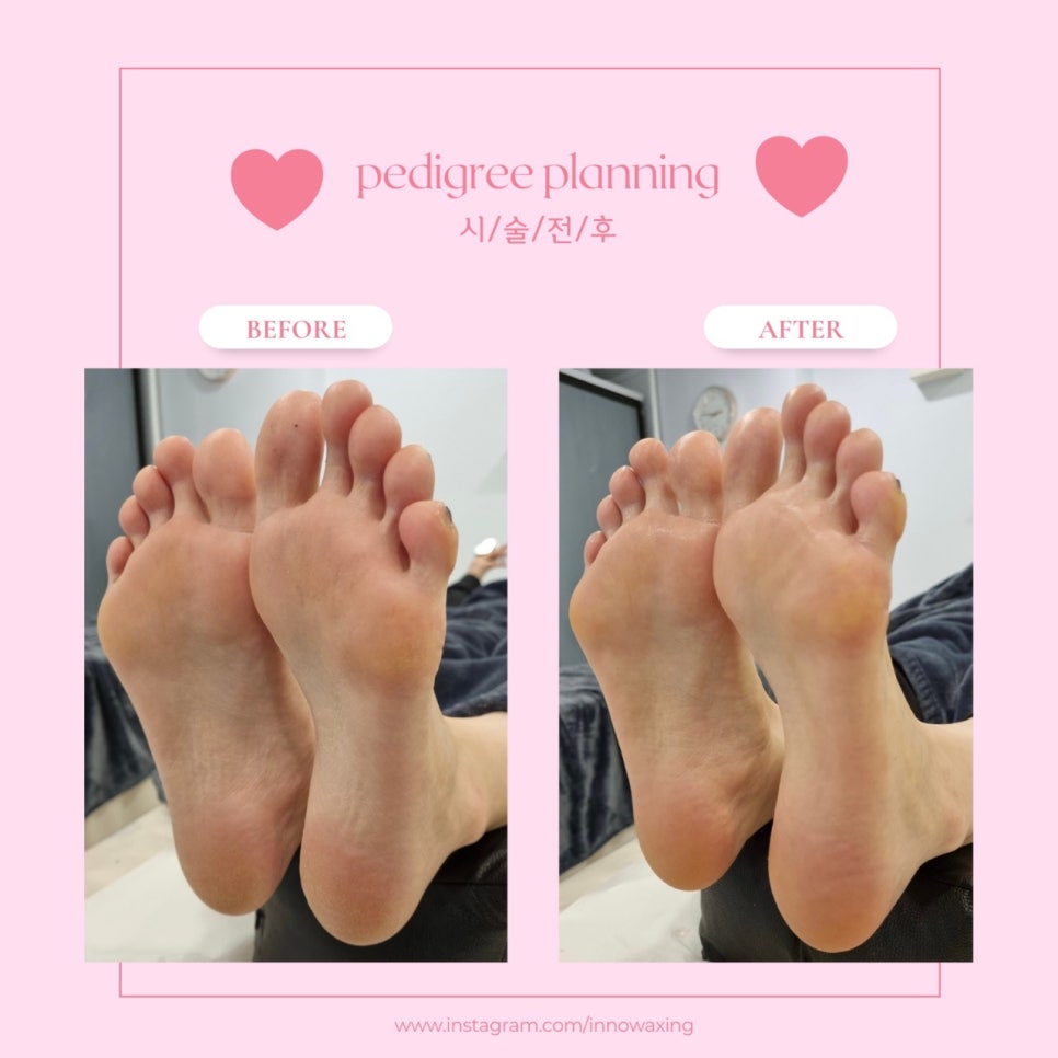 이노플래닝 이미지