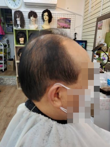 셀모가발 이미지