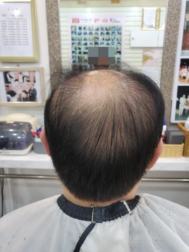 셀모가발 이미지