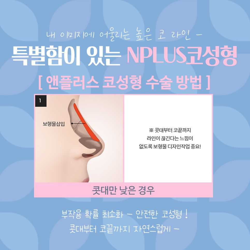여자코수술후기 코 내부까지 확인하고 관련 이미지 10