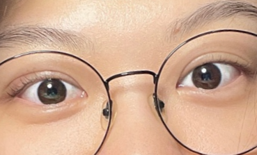 아이닉안과의원 이미지