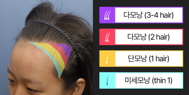 더헤어라인성형외과의원 이미지
