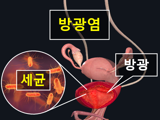 하이닥터 이미지