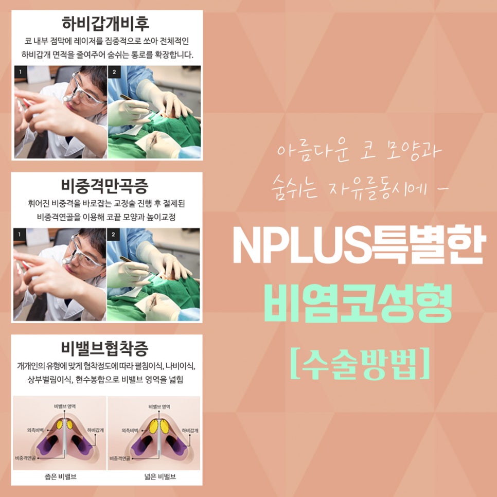 Nasal Surgery Review, Considering a Beautiful Nose Line image 9