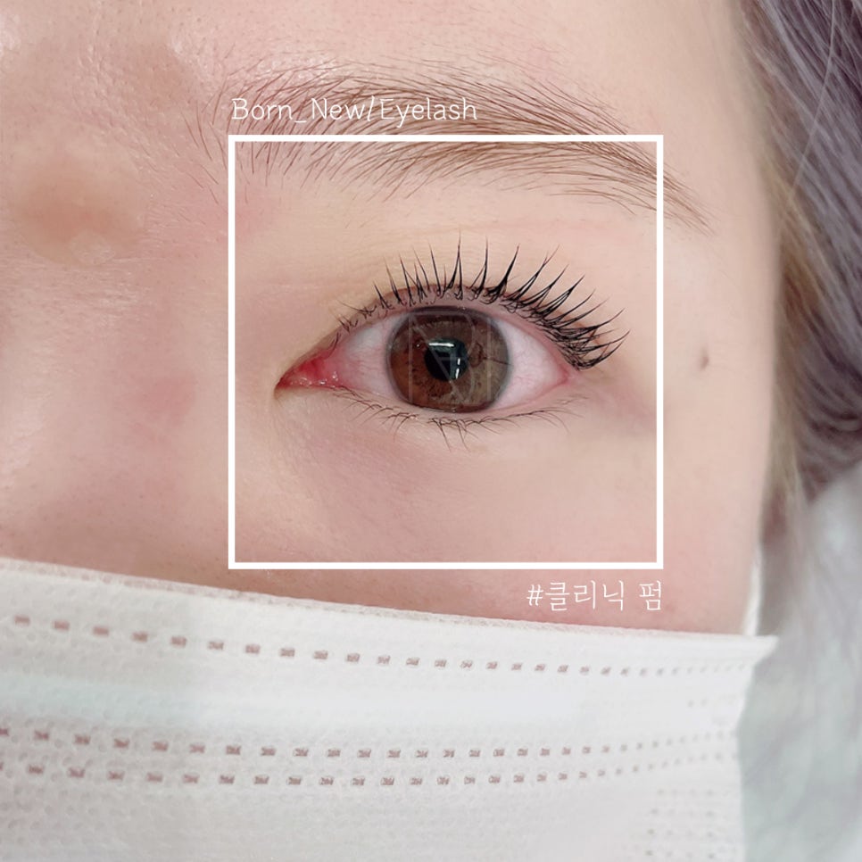 본뉴 이미지
