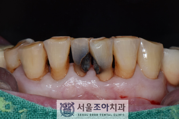 서울조아치과 이미지