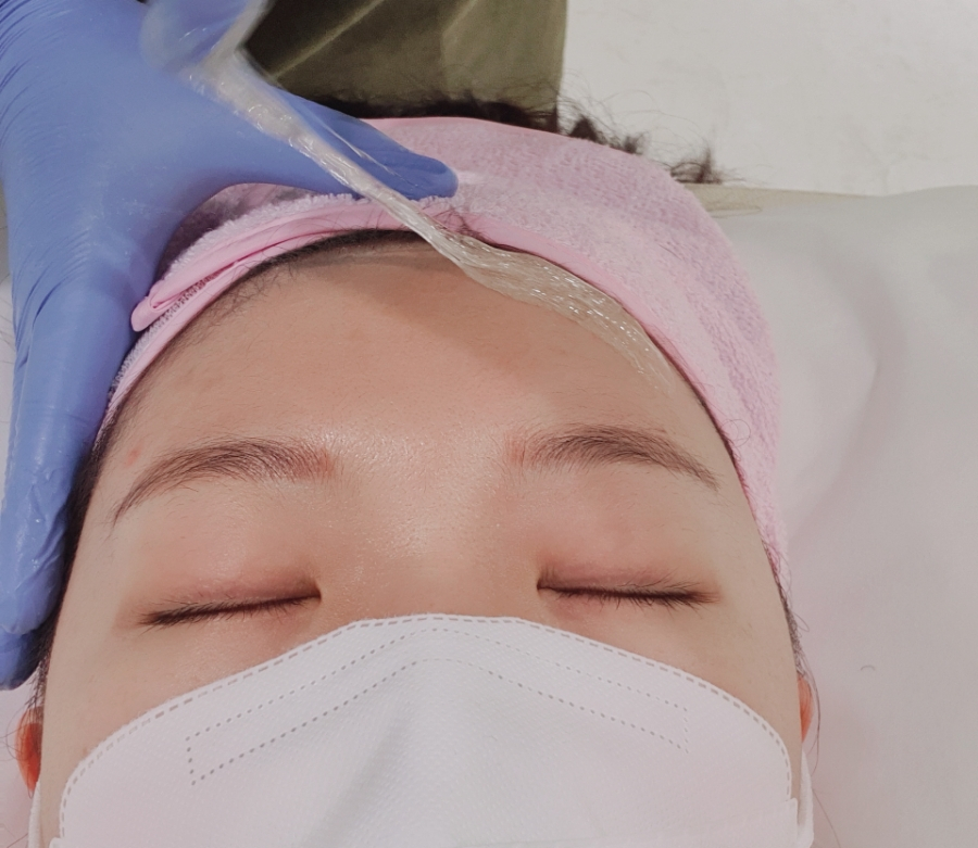모모헤어라인 이미지