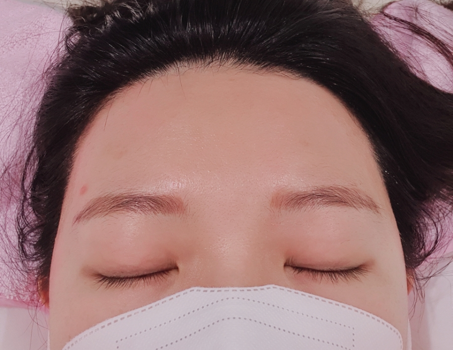 모모헤어라인 이미지