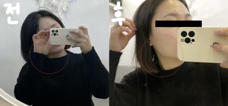 누가토탈케어 이미지