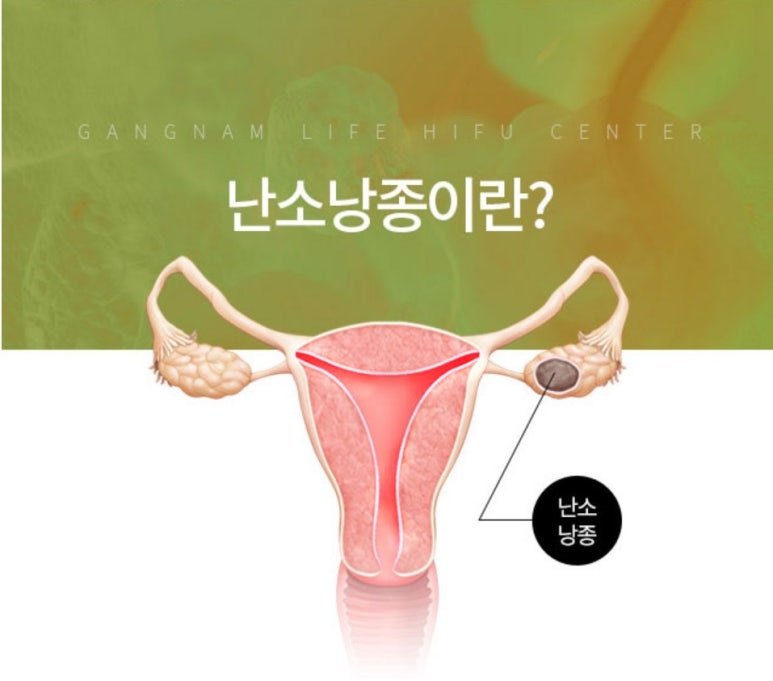 강남라이프산부인과 이미지