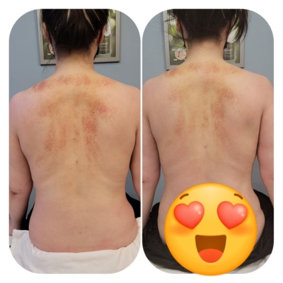 베테랑힐링테라피 이미지