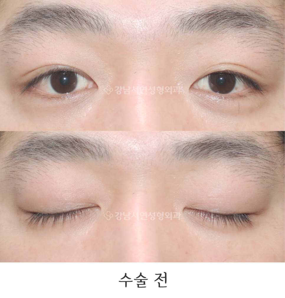 서연성형외과의원 이미지