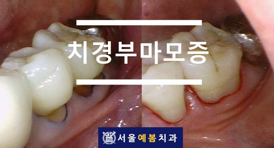 서울예봄치과 이미지